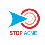stop-acne